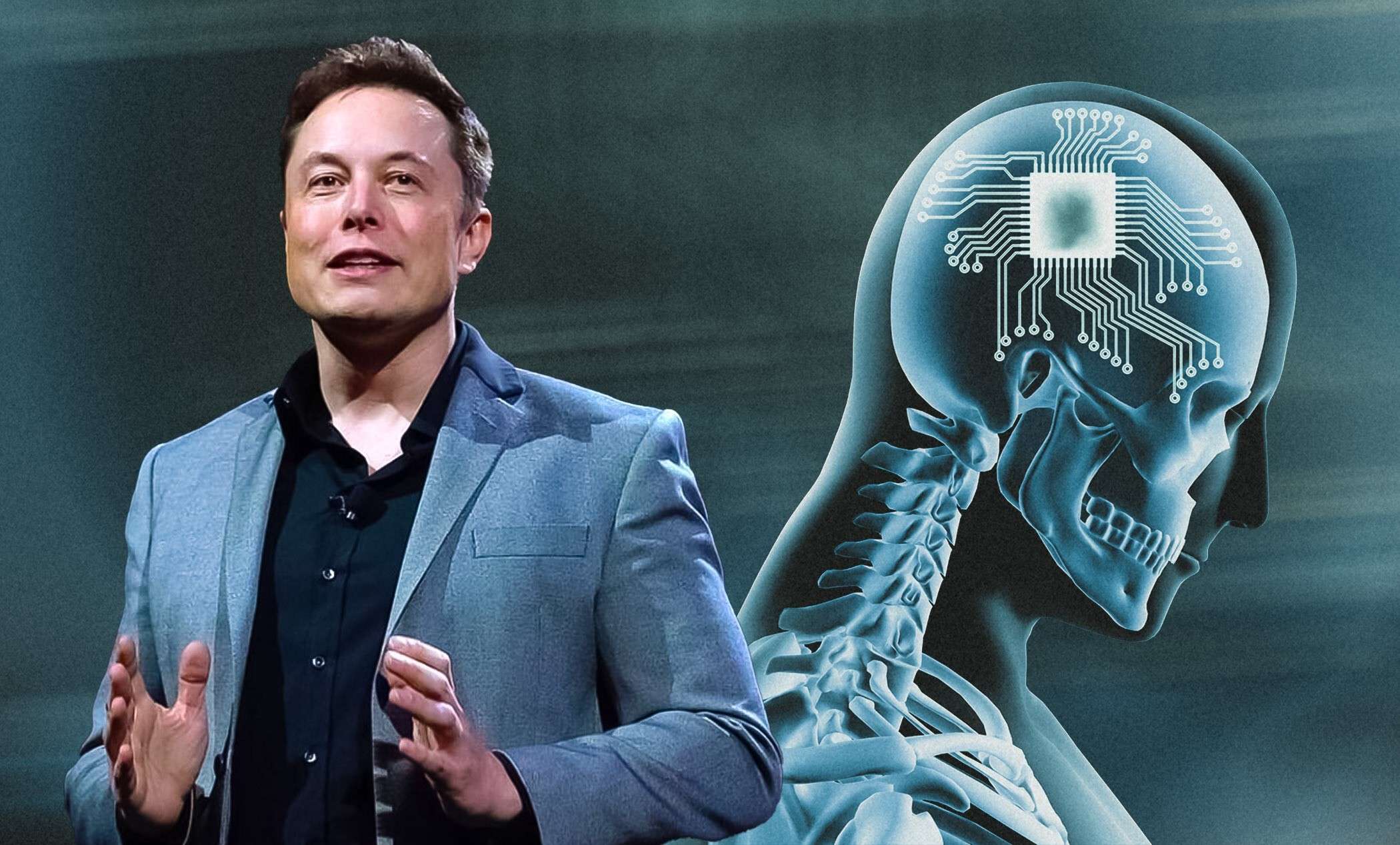 Neuralink kompanija za ugrađnju mikročipova u mozak započinje ispitivanje na ljudima ove godine