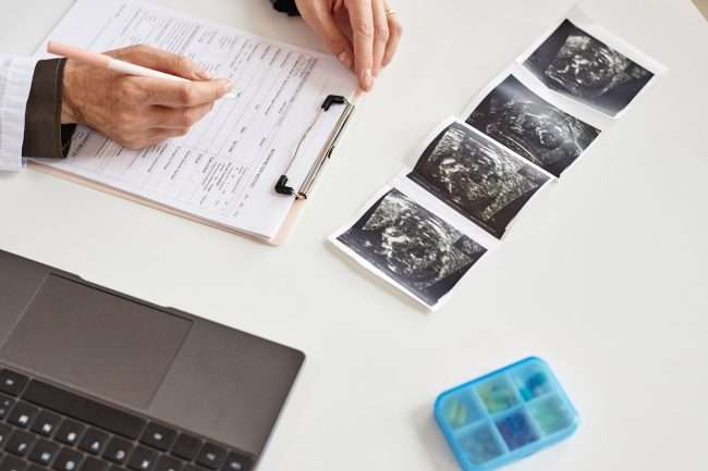 Sonogram on Gynecologists Desk in Clinic